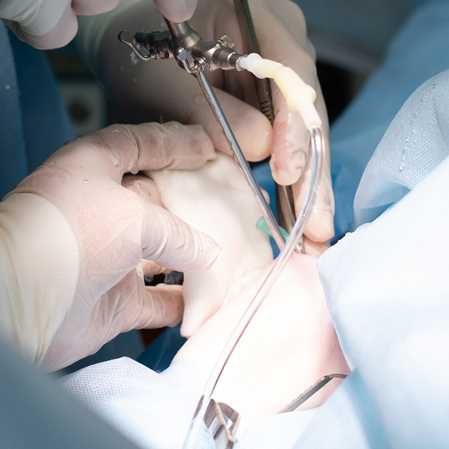 関節鏡手術とは？