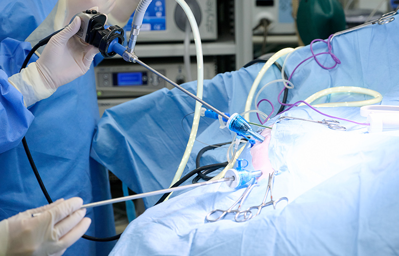 CT検査と腹腔鏡を用いた負担の少ない検査