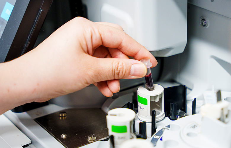 予防医療の主な目的